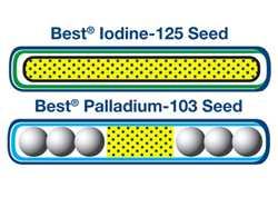 Brachytherapy Seeds