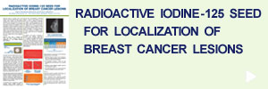 Radioactive Iodine-125 for Localization of Breast Cancer Lesions